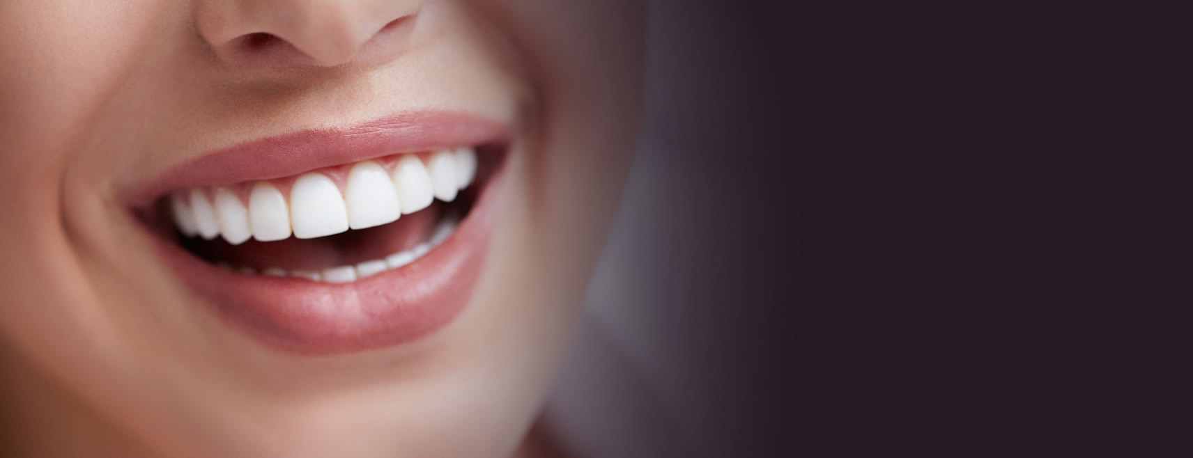 Porcelain veneers London